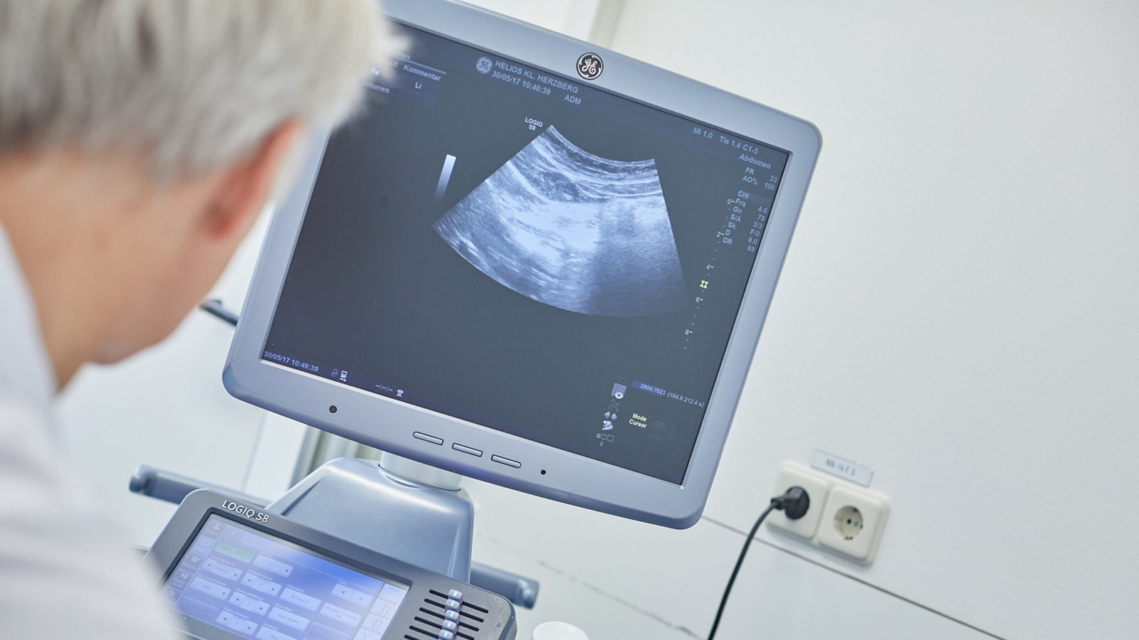 From chemotherapy to surgery: a pancreatic cancer patient’s story